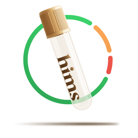 Partially-filled test tube vial with a circular line chart graphic behind it representing lab results in different categories